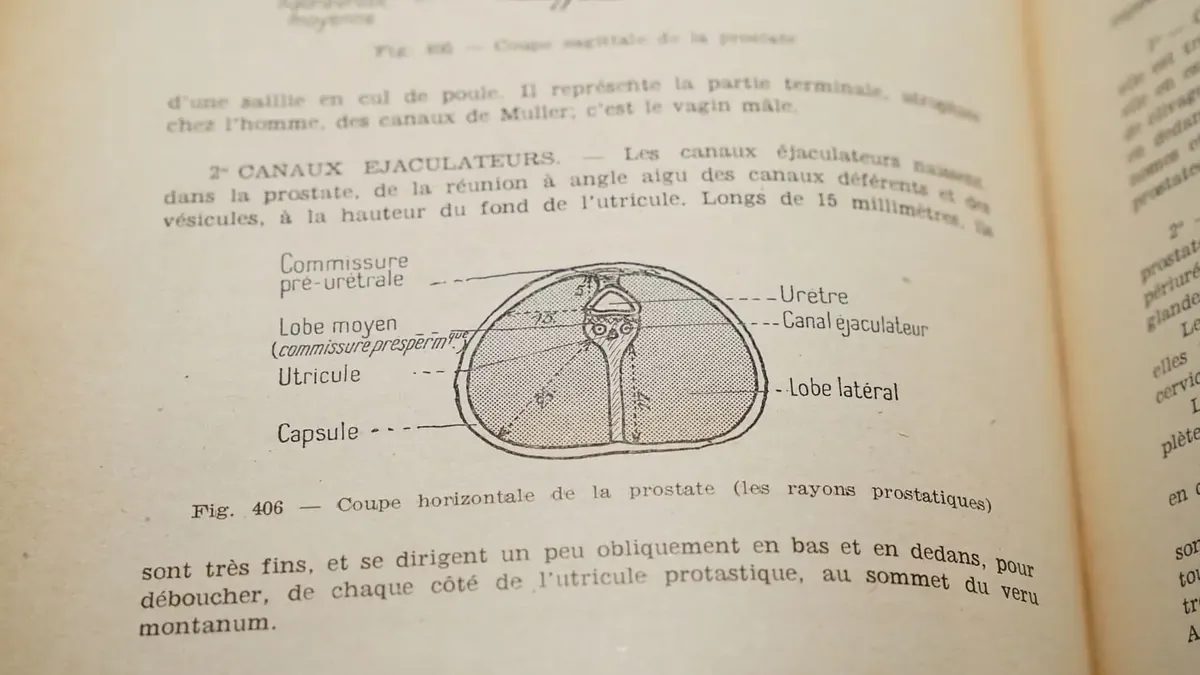 Anatomical diagram in cross-section of the prostate: lateral lobes, middle lobe, urethra and ejaculatory ducts