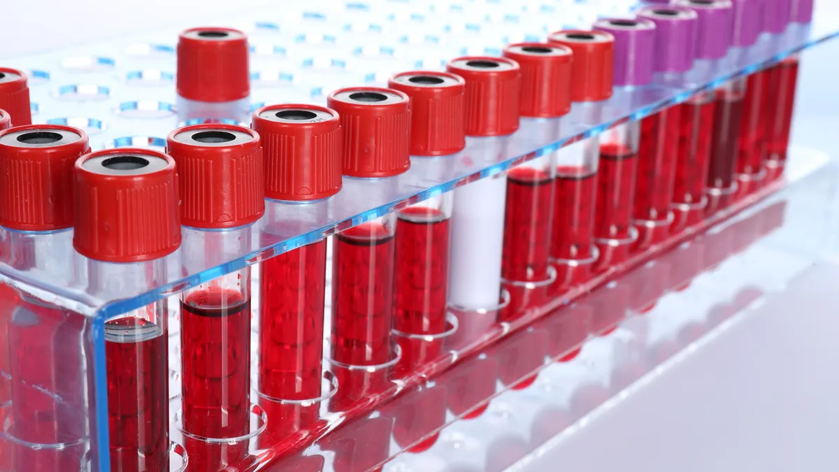 Blood collection tubes in the analysis laboratory for PSA testing