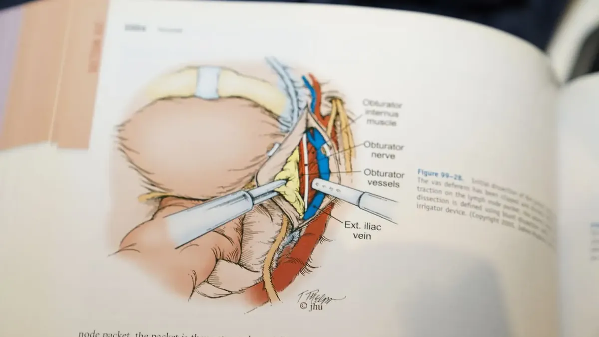 Anatomical diagram: prostate, bladder, rectum and neurovascular bundles in surgical view