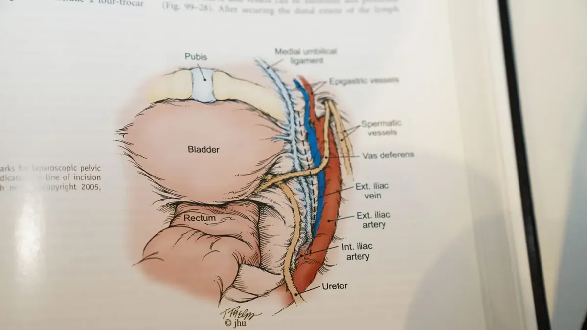 Anatomical diagram of the prostate, bladder, and neurovascular bundles responsible for erection